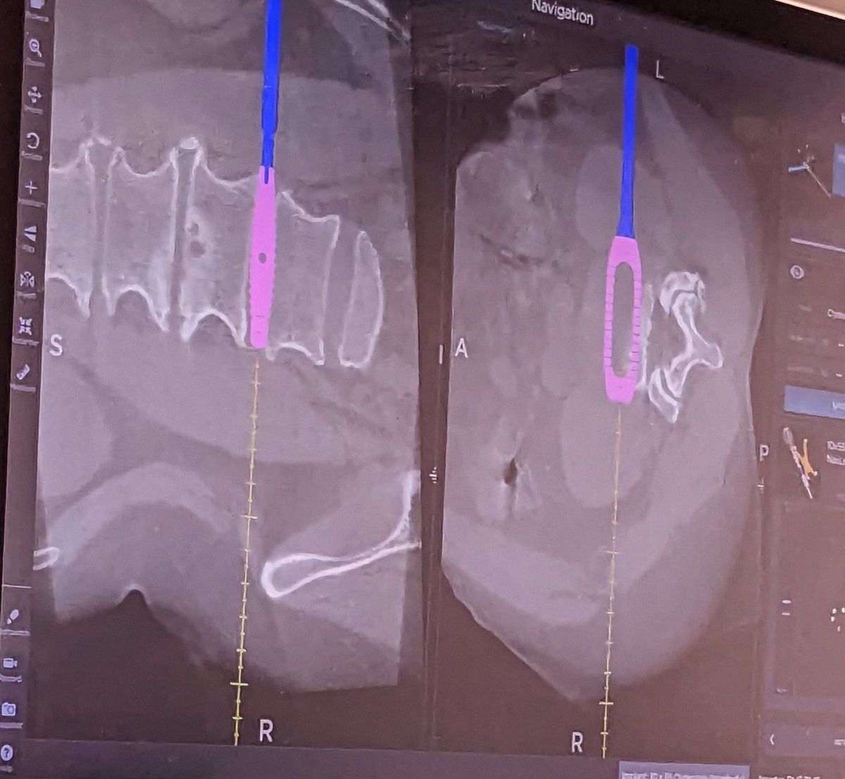 Deep Guha, MD, PhD tweet media