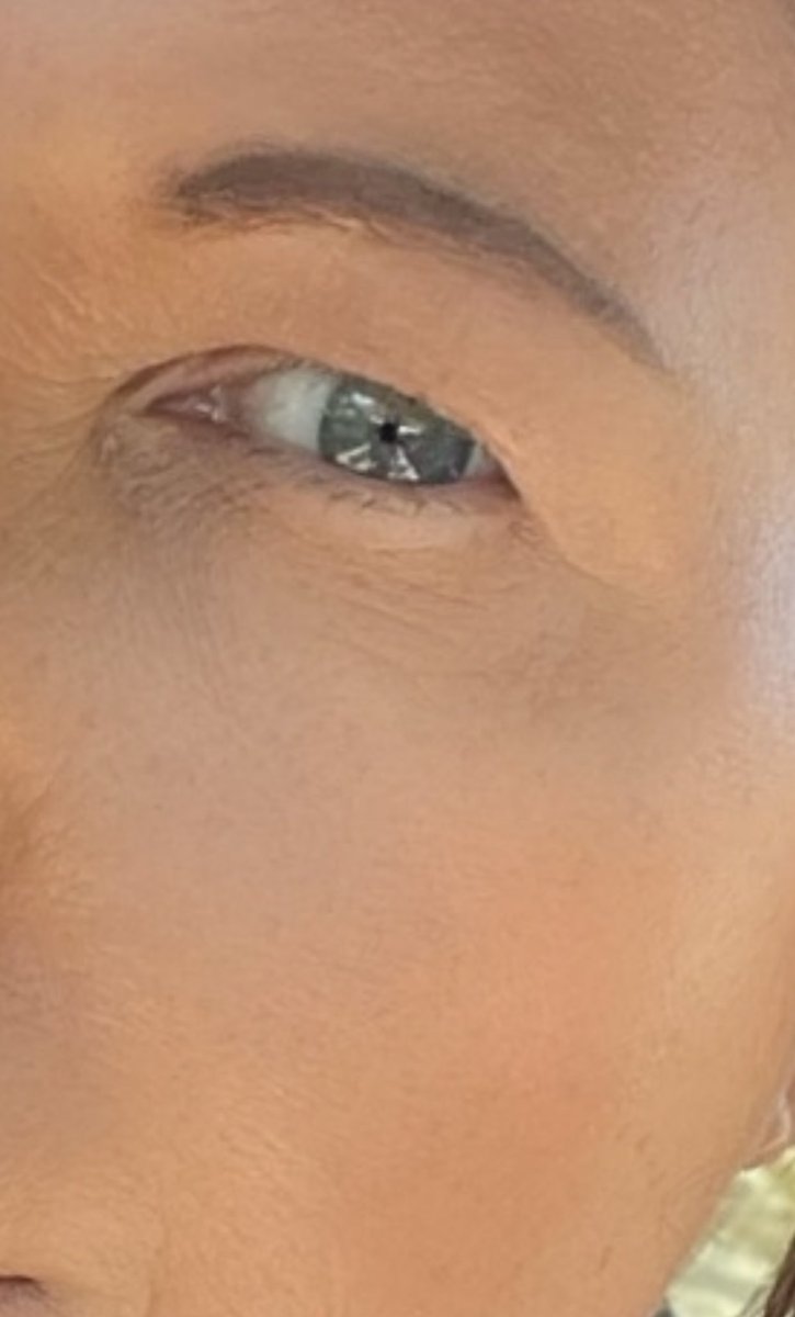 Jen_Royle's tweet photo. Finally having much-needed surgery on my eyelids before they completely blind me. Has anyone had this procedure?
Details please. https://t.co/xDPqUl42gt