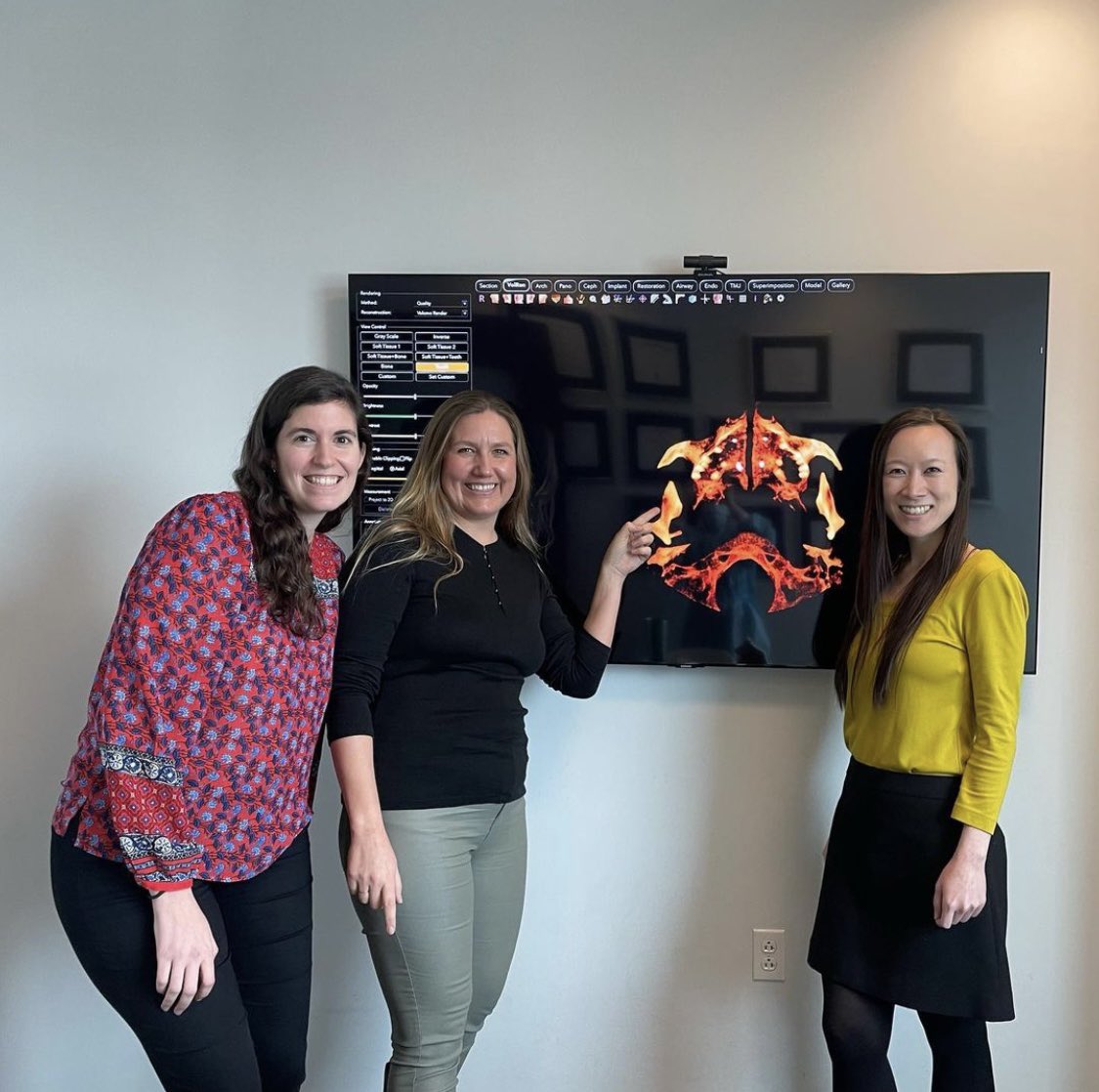 Penn_ENT's tweet photo. It’s #WomenInMedicineWednesday! Pictured are a couple #WomenInMedicine, Drs. Julianna Rodin and Yi Cai, who spent time learning from the orthodontic practice of Dr. Marianna Evans! Dr. Evans is an Adjunct Professor at @PennSleepSurg. Together they collaborate to understand OSA! https://t.co/qlkn65Hu72