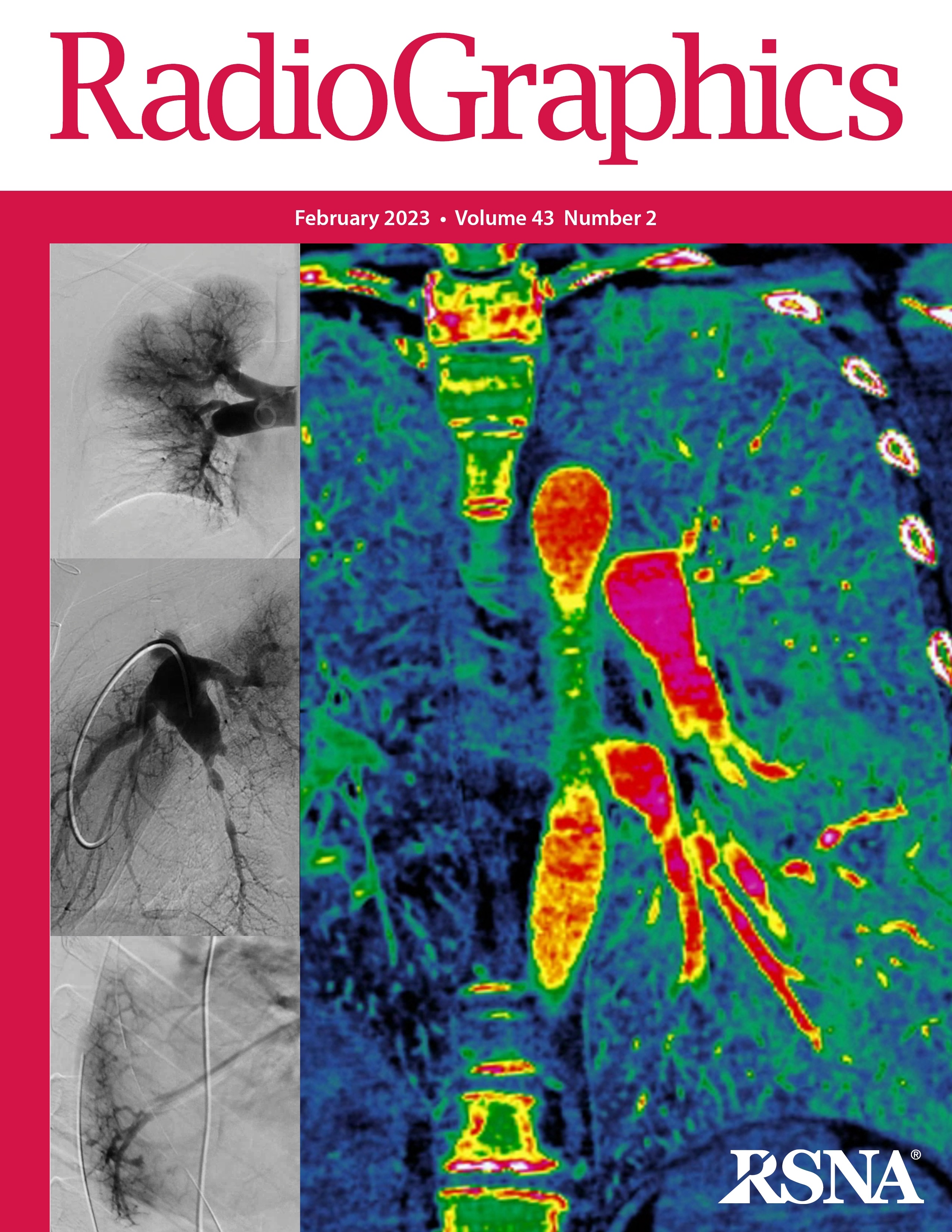 RadioGraphics (RadioGraphics) / Twitter