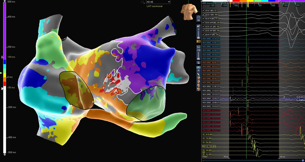 Renan Uehara tweet media