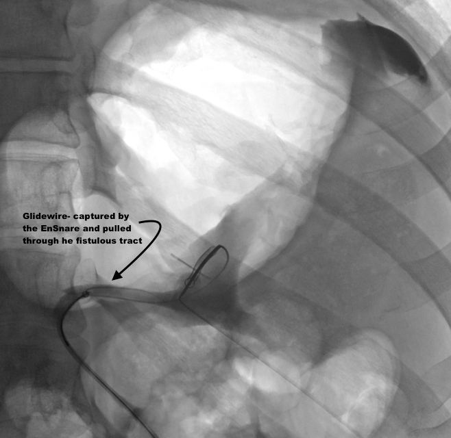 Steven Morales-Rivera, MD tweet media