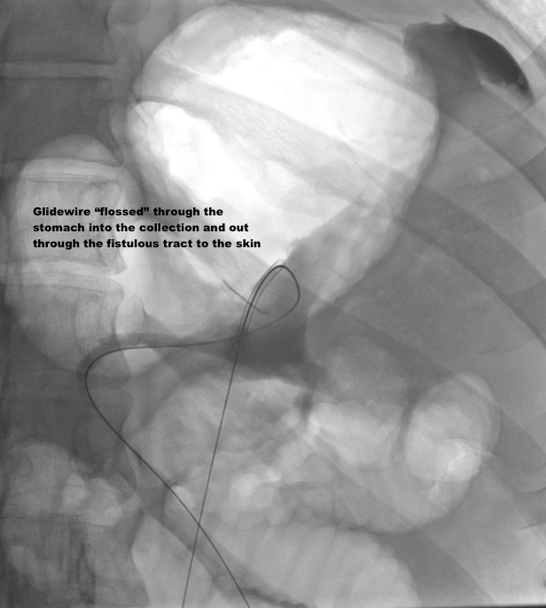 Steven Morales-Rivera, MD tweet media