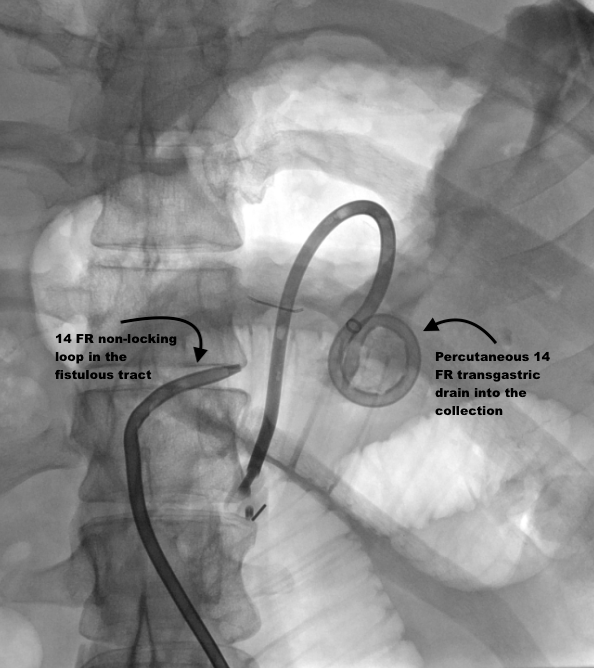 Steven Morales-Rivera, MD tweet media