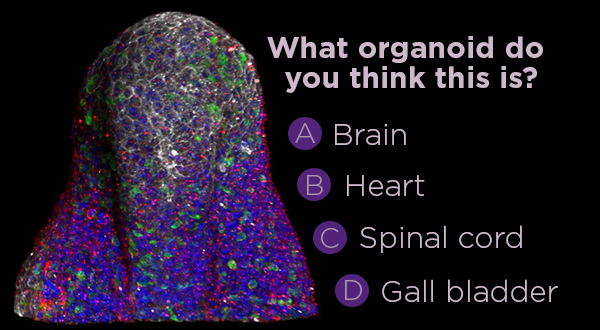 Give it a go!
@AIBNatUQ wants to know what do you think this #organoid is?⬇️🧐