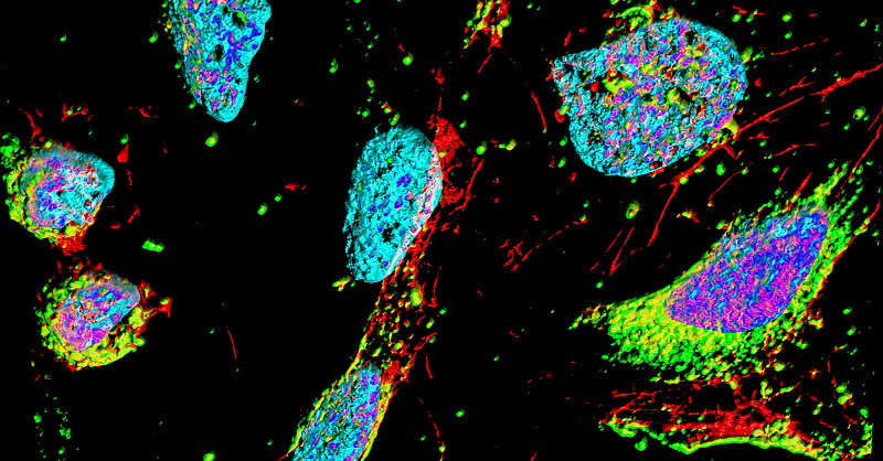 HokkaidoUni's tweet photo. A new microscopic technique allows for the real-time study of #RNA #Gquadruplex in living cells, with implications for treating amyotrophic lateral sclerosis.
Read more below ๐
#Gquad #RG4 #microscopy #trast #fluorescence #ALS #science #research #HokkaidoUniversity #ๅๆตท้ๅคงๅญฆ