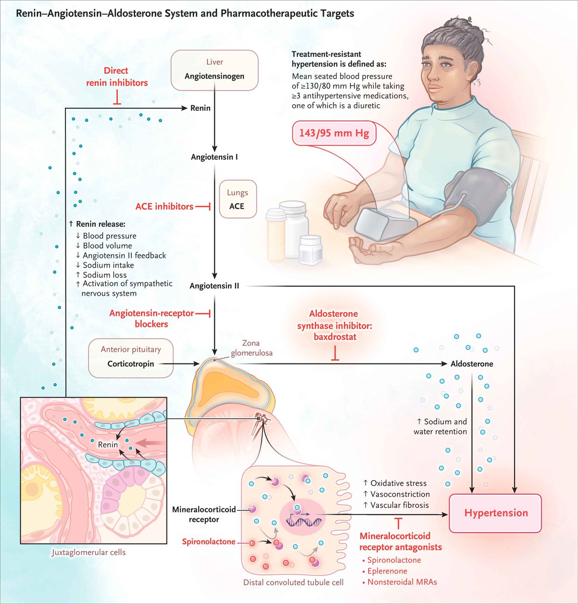 Renin-Angiotensin-Aldosterone System and Pharmacotherapeutic Targets 

<a href="/NEJM/">NEJM</a> #TipsForNewDocs #MedEd #MedTwitter #medicine #medical #medicare #health #healthcare #FOAMed #ClinicalPearl #clinicaltips #MedStudents

nejm.org/doi/full/10.10…