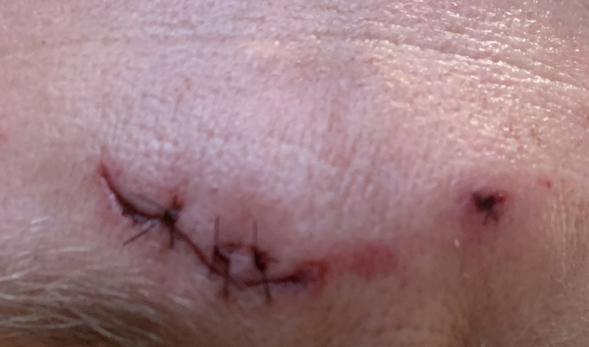 Alright #medtwittter take the survey and let’s here your thoughts.

Does this scar?