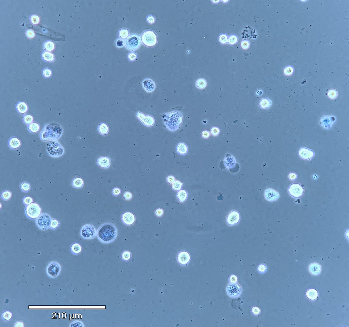 Had the pleasure of working with the amazing Valerie Johnson to prepare elephant stem cells for treating Lisa (an African elephant) at the Oakland zoo and these cool Kudu antelope cells for the SF zoo-penguins next in line! <a href="/OaklandZoo/">Oakland Zoo</a> <a href="/sfzoo/">San Francisco Zoo & Gardens</a>