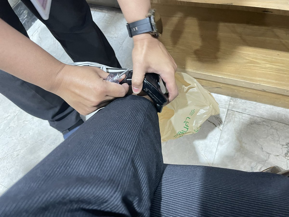 ได้ปลด EM แล้วครับ