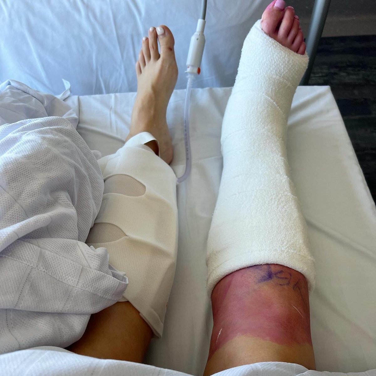 Day one 🔩🦿🤝🏼 ready for the comeback 🫡