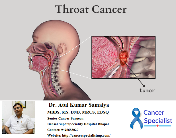 oncologist_bpl's tweet photo. Throat Cancer Symptoms – 
•Voice changes like cracking, hoarseness, or trouble speaking clearly
•Trouble swallowing or breathing
•Feeling like something’s caught in your throat
•Sore throat, cough (possibly with blood), or earache that won’t go away
•Pain in your ears https://t.co/VNYn13yn1u