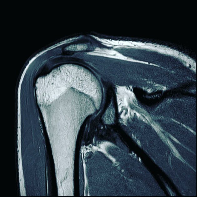 CheltChiropractic tweet media