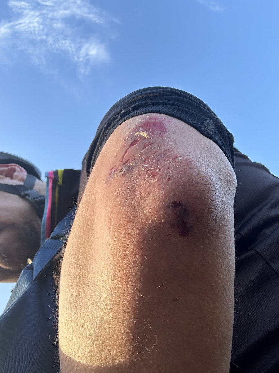 CycleGaz™ tweet media