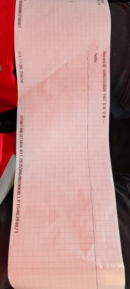 AliMedic_'s tweet photo. What is the Rhythm? https://t.co/bkU0qlKYle
