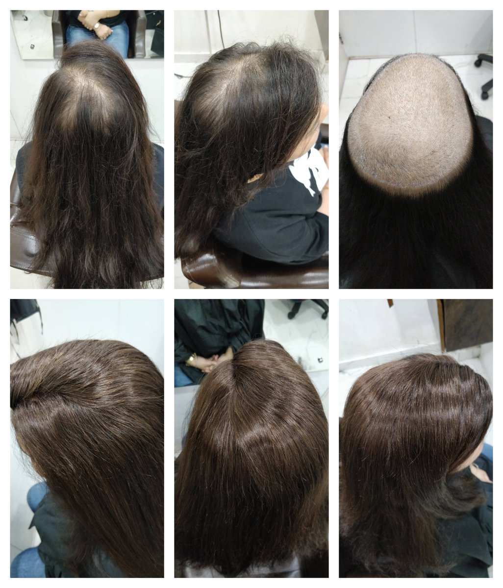 Prem Hair Expert (@HairLynx) / Twitter Prem Hair Expert (@HairLynx) / Twitter
