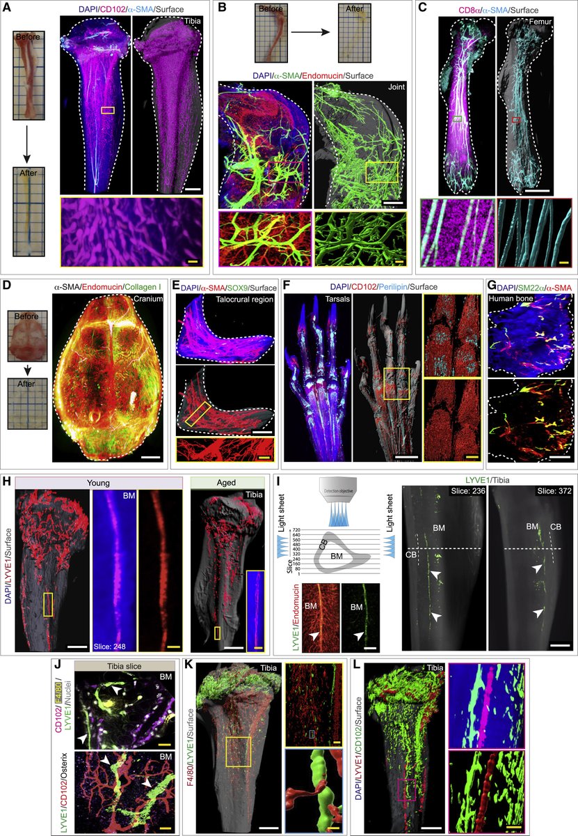 miltenyibiotec's tweet photo. Lymphatic vessels in bone tissue? Yes, you read that right. See how the UltraMicroscope supported this fantastic work from Dr. Anjali P. Kusumbe and team, recently published in Cell. 👉 https://t.co/hGGpeeOFDW https://t.co/EogJMnTWUw