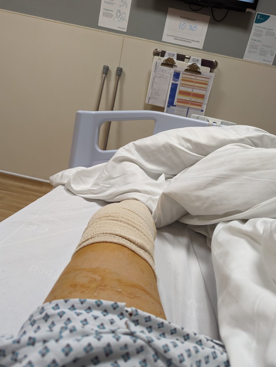 hannahlufc92's tweet photo. 2nd left knee operation in 4 years, hoping this will be the last for a while. 🤞🏼 #recoverystartsnow #kneeoperation https://t.co/GUK2S6YiOF