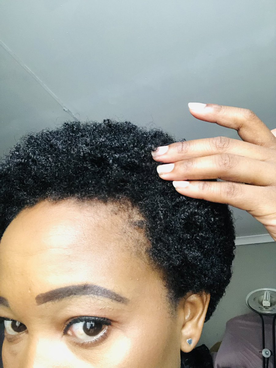 nonitheotiginal's tweet photo. Hi guys I am back with an update, my hairline is back , not strong but back Cuticura is goated in my books https://t.co/fTvOH1ZYHv