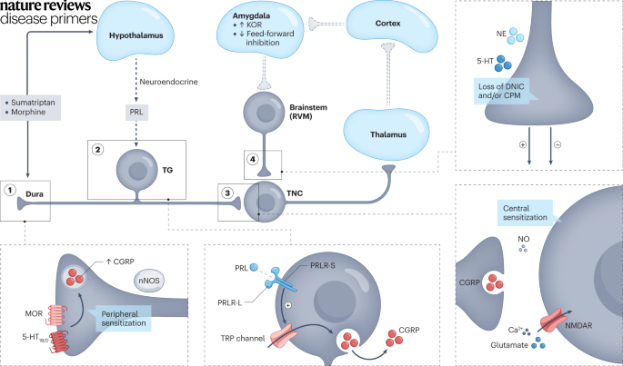 Several cellular and molecular changes in pain processing pathways might be involved in the pathophysiology of medication overuse #headache. go.nature.com/3XZtJen