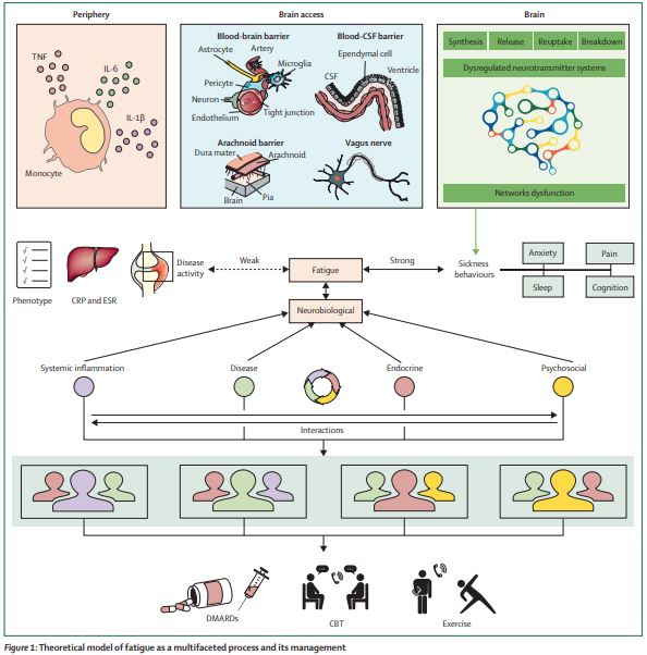 The Lancet Rheumatology (@thelancetrheum) on Twitter photo NEW Review—Brain mapping inflammatory-arthritis-related #fatigue in the pursuit of novel therapeutics thelancet.com/journals/lanrh… <a href="/salim_alwasity/">Dr. Salim Al-Wasity</a> @GordonDW_MI8 <a href="/UofGlasgow/">University of Glasgow</a> NEW Review—Brain mapping inflammatory-arthritis-related #fatigue in the pursuit of novel therapeutics thelancet.com/journals/lanrh… <a href="/salim_alwasity/">Dr. Salim Al-Wasity</a> @GordonDW_MI8 <a href="/UofGlasgow/">University of Glasgow</a>
