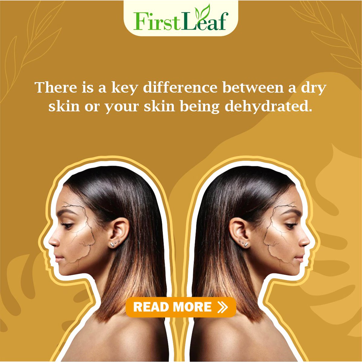 BuyFirstLeaf's tweet photo. Dry or Dehydrated skin!
Well..both #skin types need moisturizing &amp; hydration. Dry skin needs it all year round but more so during winter. 
Get your skin to be soft &amp; smooth with all-season #FirstLeaf #AloeveraGels combined with Turmeric &amp; Manjistha.

#aloevera #turmericgel https://t.co/8TmrnrFuCU
