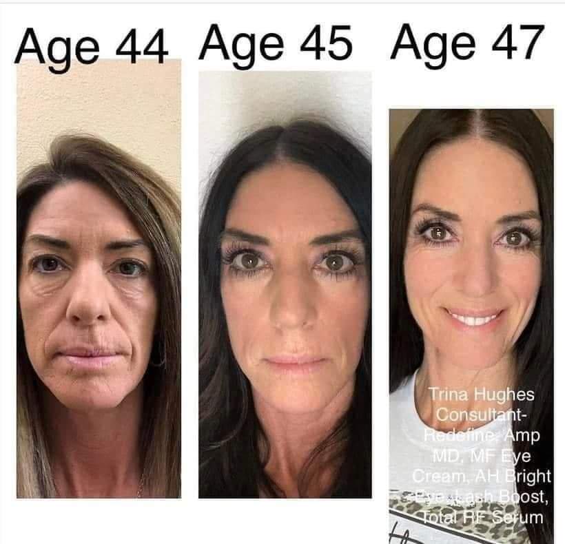 🌟The #1 anti-aging brand in the U.S.👱🏼‍♂️👱🏻‍♀️🌟

Let's get you started today!

#redefineyourself #agingbackwards #60daymoneybackguarantee #joinmyteam #rodanandfields #rf  #agingbackwards
#skincare #menhaveskintoo #Soothe #RodanAndFields #AntiAging #lifechangingskincare #wrinkles #men