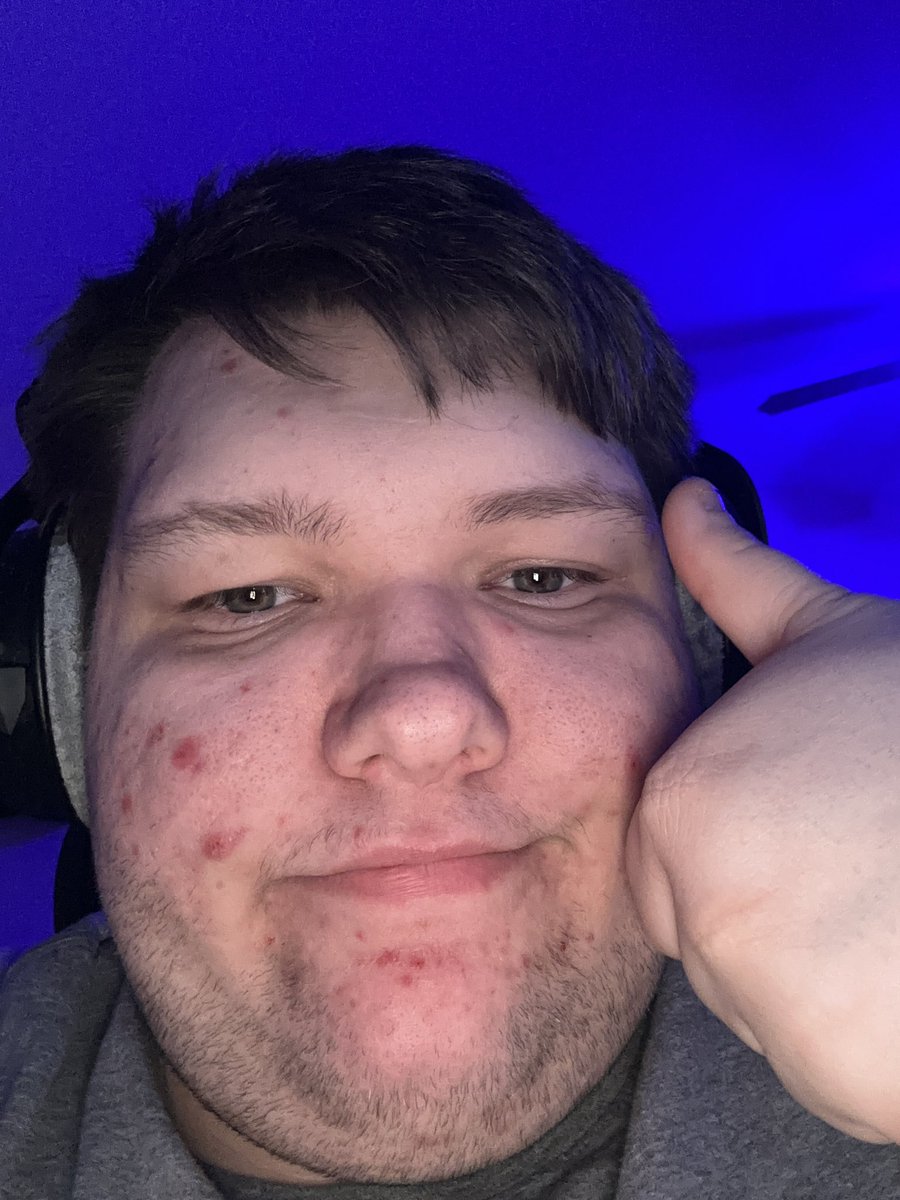 Fresheys 💫 tweet media