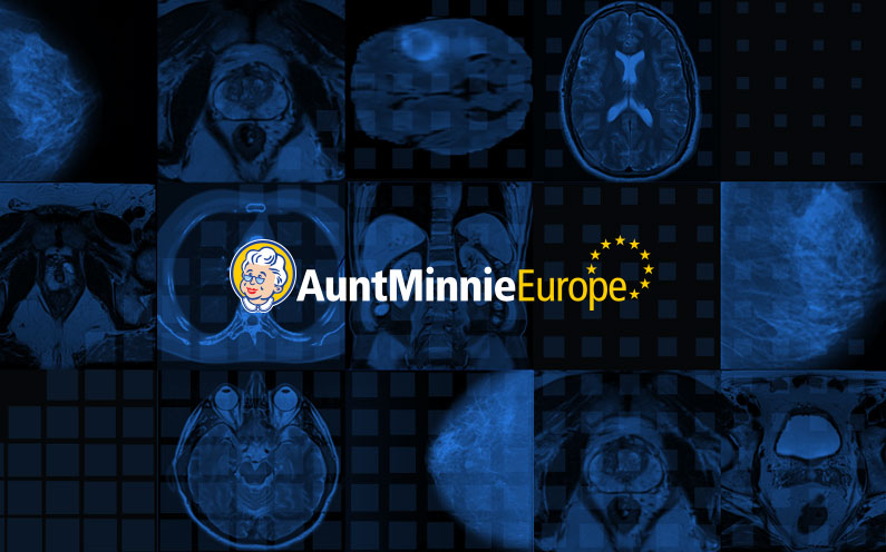 CancerCenterAi's tweet photo. The EuroMinnies recognize the best and brightest in European radiology, and this year's list of semifinal candidates includes Cancer https://t.co/4GD4ogTuJB module for radiologists. You can read the full article here: https://t.co/IXbqZckGHh https://t.co/Vg87xM9hqf