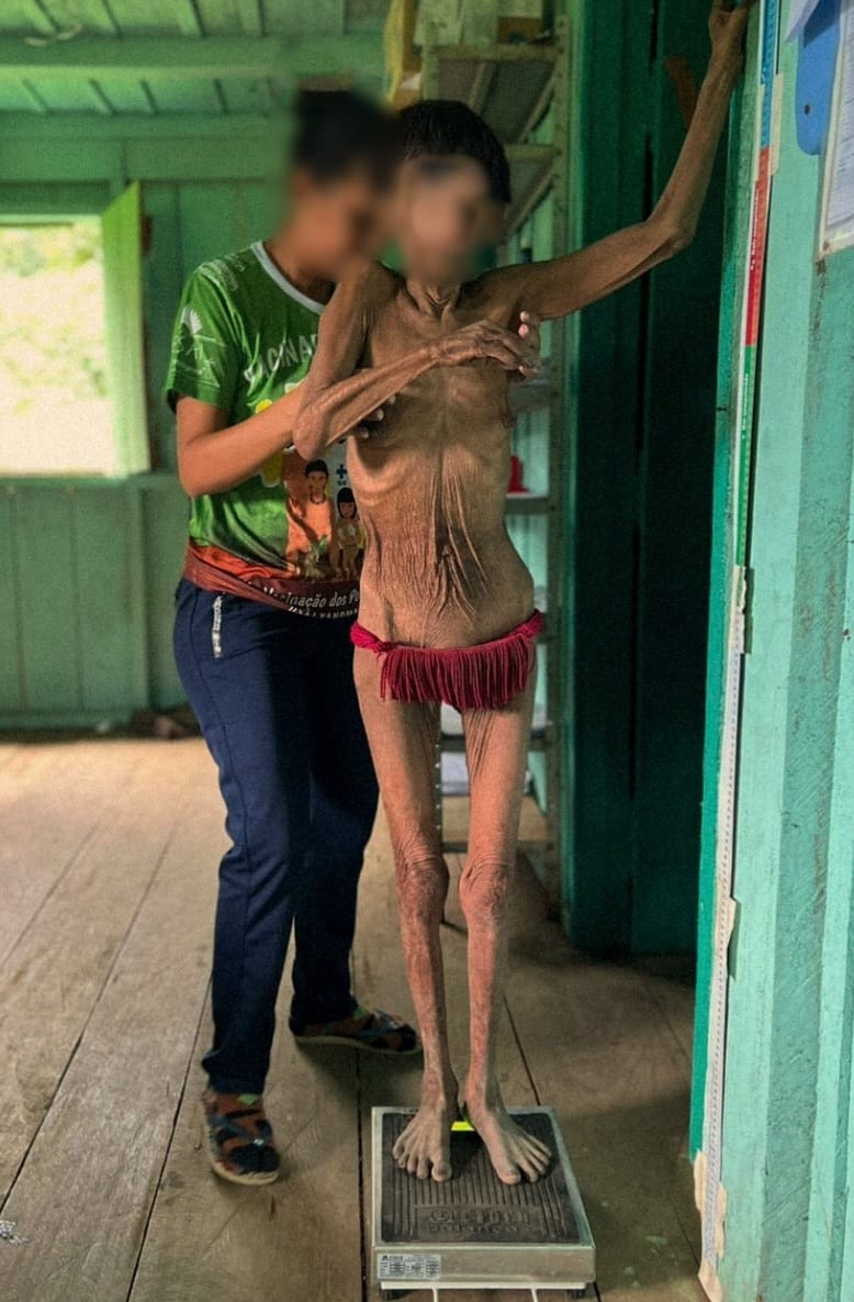 lovelybrazilian's tweet photo. Se, após ver essas imagens, saber o que aconteceu ao povo yanomami em Roraima, nos 4 anos do DES governo Bolsonaro, você continuar defendendo o genocida, por favor, fique bem longe de mim, porque você é pior que ele. https://t.co/02CvEonR07