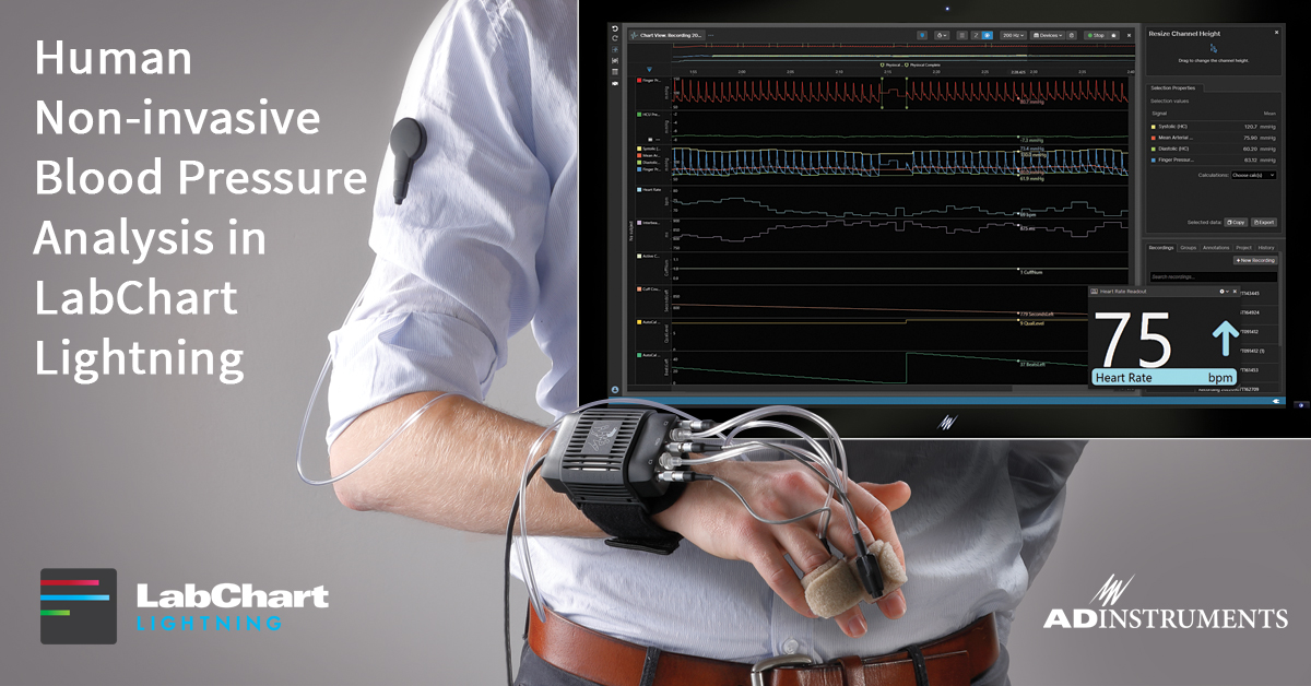 ADInstruments's tweet image. Use powerful analysis features in #LabChartLightning to record human non-invasive blood pressure with the hNIBP Nano System!
👉 adi.to/LCL-hNIBP 👈
❤️ Measure continuous BP signal
❤️ Calculate true beat-by-beat Systolic, Diastolic, and Mean Arterial signals
#ADInstruments