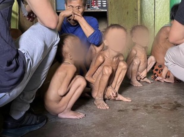 Resultado de 4 anos de um genocida no poder: 570 crianças yanomamis morreram de fome.