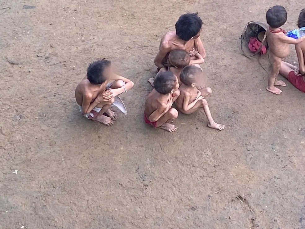 aavasantiago's tweet photo. Essas imagens são completamente devastadoras. Bolsonaro, com a cumplicidade do exército brasileiro, instalou uma atrocidade análoga ao Holocausto no território indígena Yanomami. Todas as lideranças evangélicas que nos acusaram de defender assassinos de bebês estão em silêncio. https://t.co/TtQ7y2rA2x