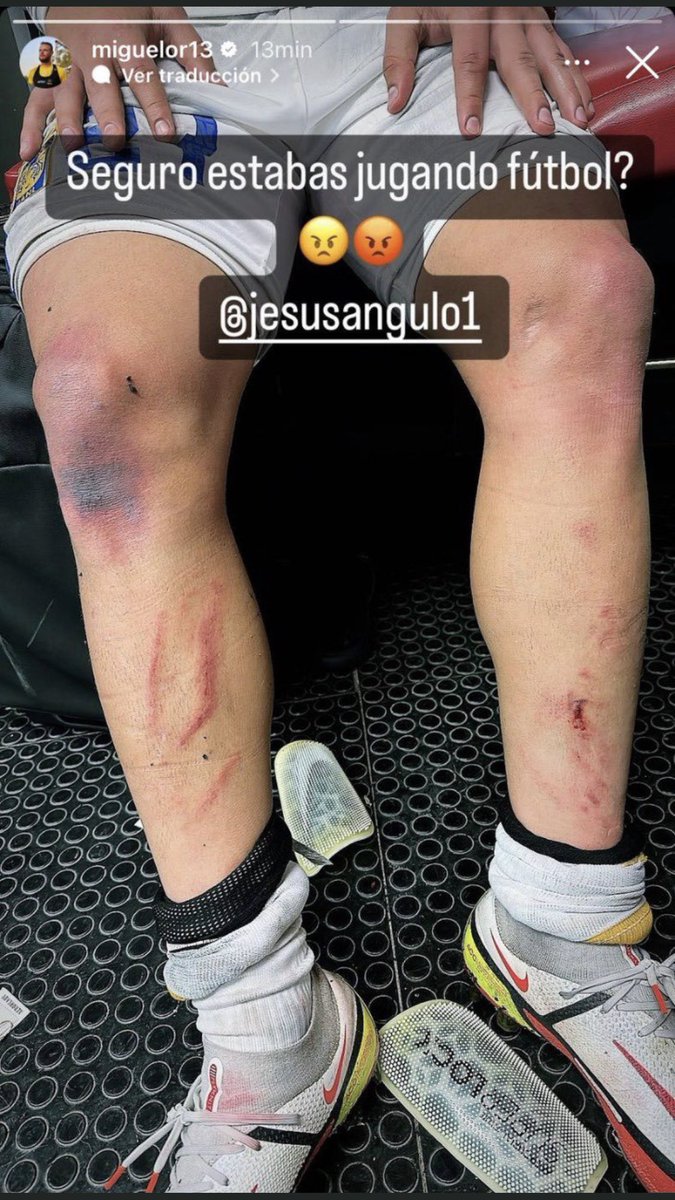 axelsolisrmz's tweet photo. #SinYolanda
Resultado al jugar en una cancha sintética !
Más roces y más contacto entre jugadores 
#JesusAngulo
@TigresOficial 
#Xolos https://t.co/GD0UkDKudu