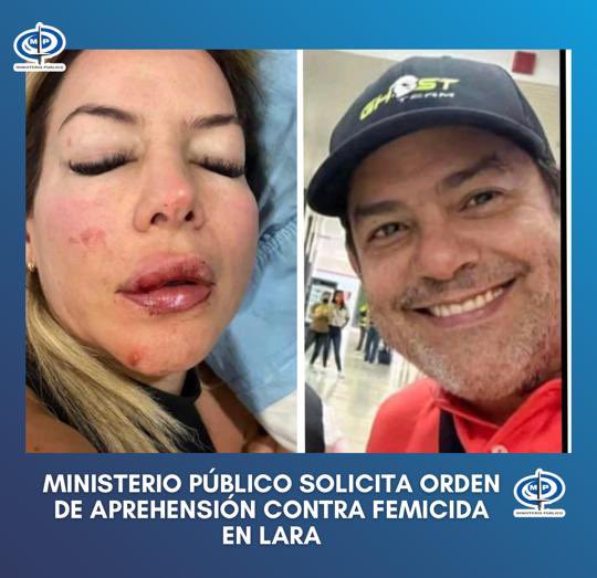 TarekWiliamSaab's tweet photo. @MinpublicoVEN Lara #designa Fiscalía 25 para #investigar y #sancionar las agresiones contra Gisell Mendoza víctima del delito de VIOLENCIA FÍSICA AGRAVADA hechas por su ex pareja Andrés Yepez, quien se encuentra prófugo y al ser #detenido se le dictará privativa de libertad https://t.co/8j1FbkrFPX