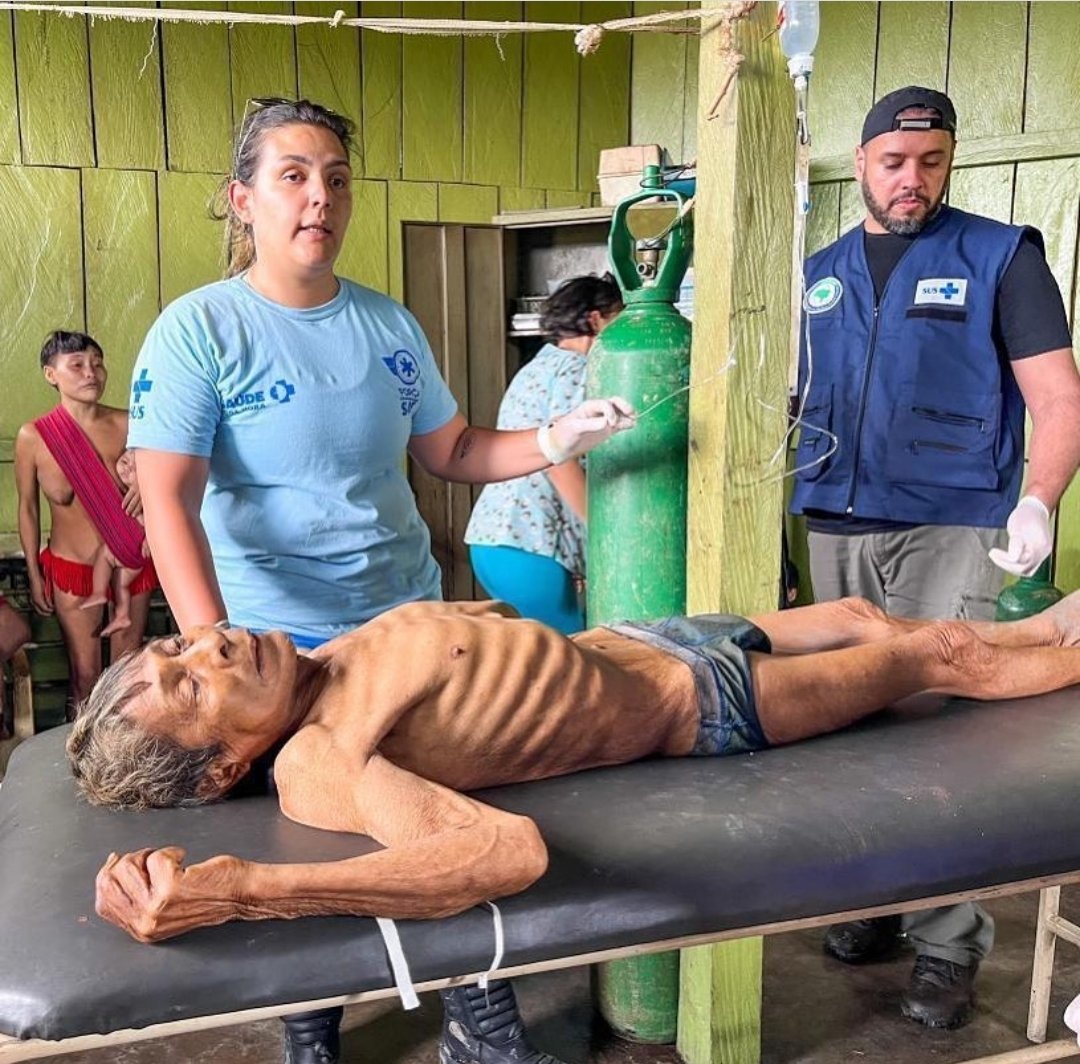 Quatro anos de abandono da saúde indígena #SOSYANOMAMI