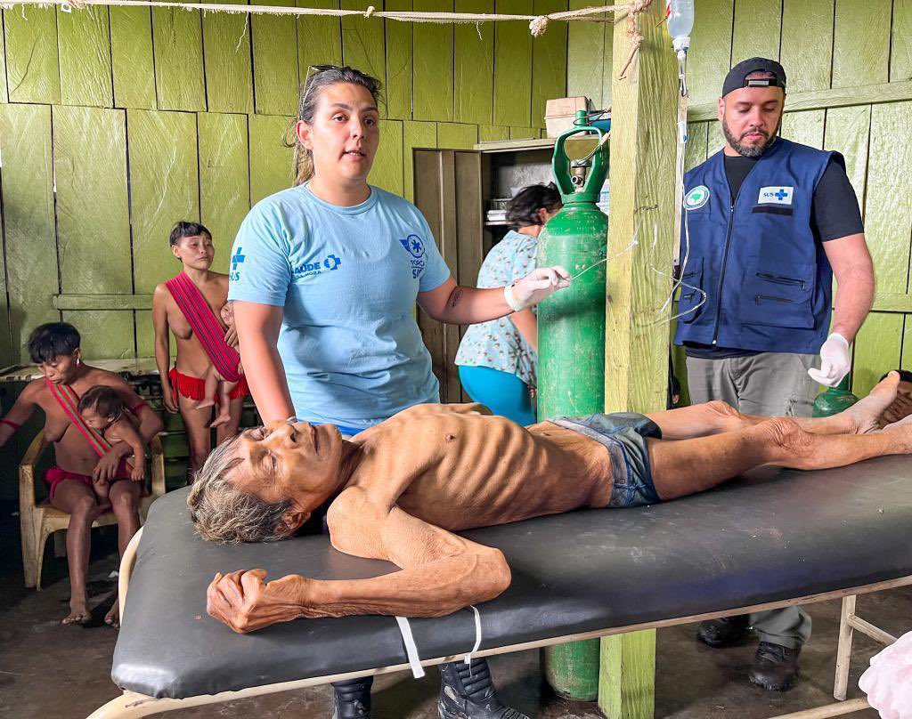 Rafael_Parente's tweet photo. Esse é o resultado de 4 anos de governo Bolsonaro, Damares e Ricardo Salles.

Mais de 540 crianças morreram de FOME. Sofrendo. Isso só em Roraima.
Para onde foi o dinheiro?
É o cúmulo do descaso e da desumanidade.

Olhem essas fotos! Esses bandidos não podem sair impunes. https://t.co/pZ5FgwaRp1