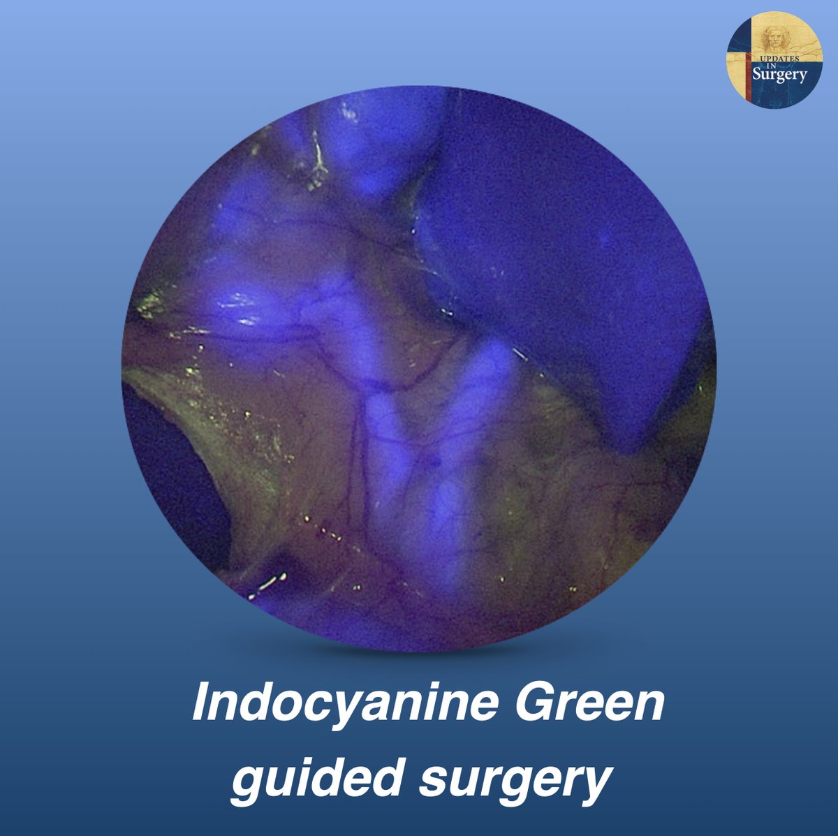 Updates in Surgery tweet media