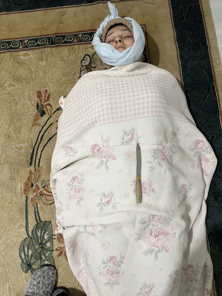 Bu ilk ölüşüm değil🤷‍♀️