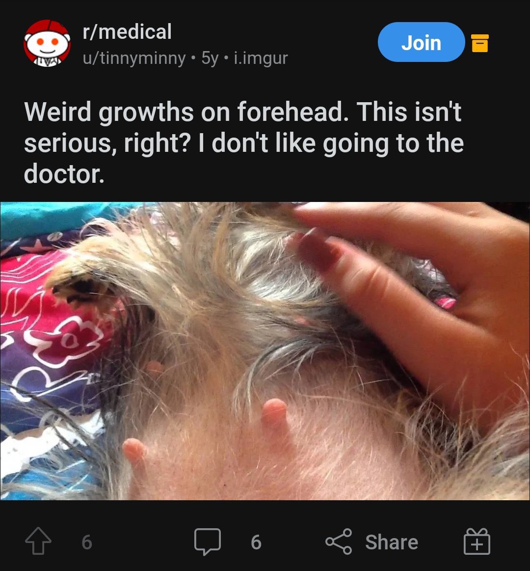 AliEzzoBezzo's tweet photo. nah this is crazy imagine waking up one day and u got cow nipples on ur head https://t.co/autqfkl9OZ