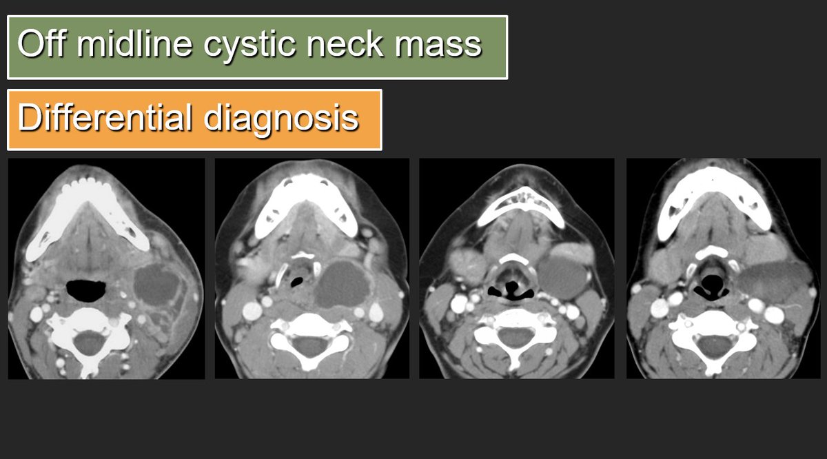 What's your differential diagnosis for off-midline cystic p(a)ediatric neck masses? #FOAMrad #FOAMed #MedEd #NeuroRad