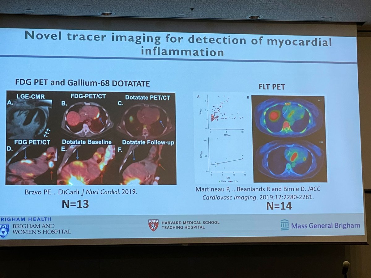 AnnaKateBarton's tweet image. #Multimodalityimaging in 🫀 Sarcoidosis
#Advances36

🔘LGE=inflammation OR scar and Rx is different for each state 
🔘 FDG PET: assess/extra cardiac inflammation BUT intense dietary prep
🔘FDG=prognostic implications
🔘Novel SPECIFIC inflammation tracers are coming (DOTATATE/FLT)