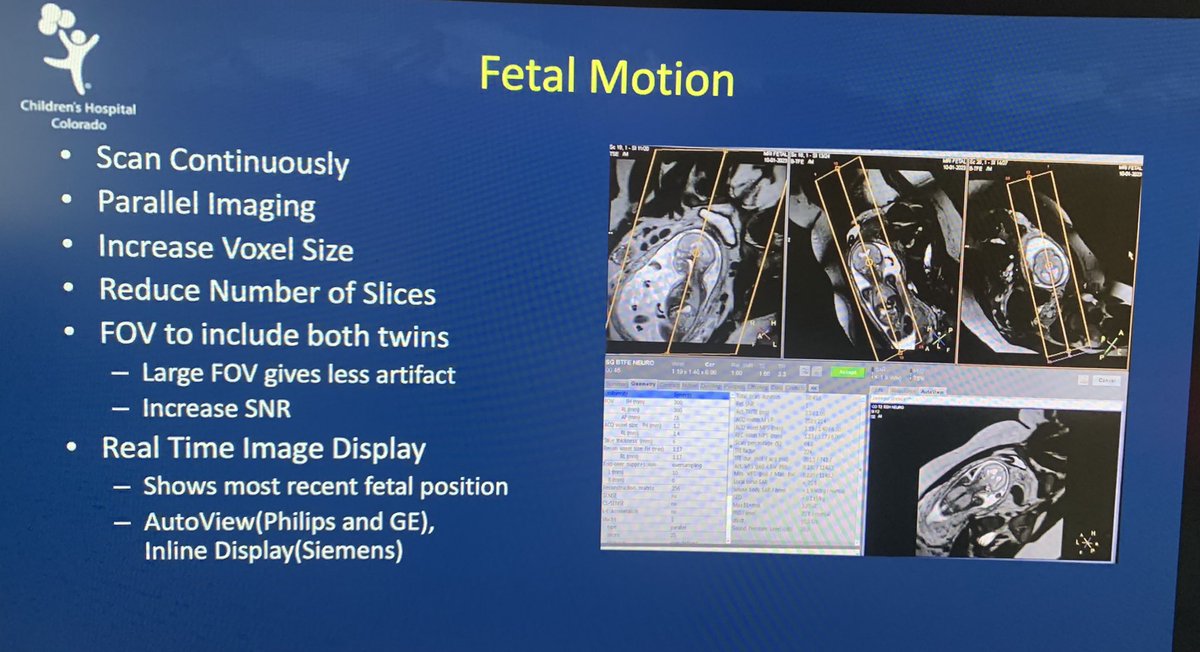 Mariana Meyers (@marianazmeyers) on Twitter photo So great to have MRI techs participation in our #SPRFetal2023 course! Sarah Smith showed us a ton or tips and tricks you can use when scanning twins. <a href="/PedsRadsColo/">CU Pediatric Radiology</a> So great to have MRI techs participation in our #SPRFetal2023 course! Sarah Smith showed us a ton or tips and tricks you can use when scanning twins. <a href="/PedsRadsColo/">CU Pediatric Radiology</a>