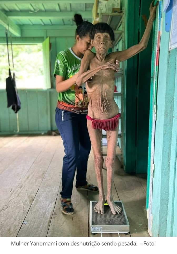 MaraTellesReal's tweet photo. O verdadeiro campo de concentração: Yanomami.

The truth concentracion camp in Brasil.

Genocidal Bolsonaro! #BolsonaroGenocidaIndigena https://t.co/56HjFucKK1