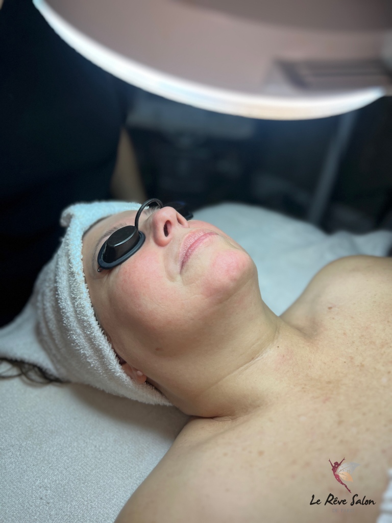LRsalonandspa's tweet photo. Dermaplaning Facial ๐
------------
Click link below to book your next appointment
(818) 923-5005
https://t.co/rbolbz5tZD
#beautysalon #beauty #salon #nails #hair #skincare #makeup #hairsalon #estheticiannearme #Granadahillsesthetician #selfcare #skin #Dermaplane https://t.co/dWgV3NhEnR