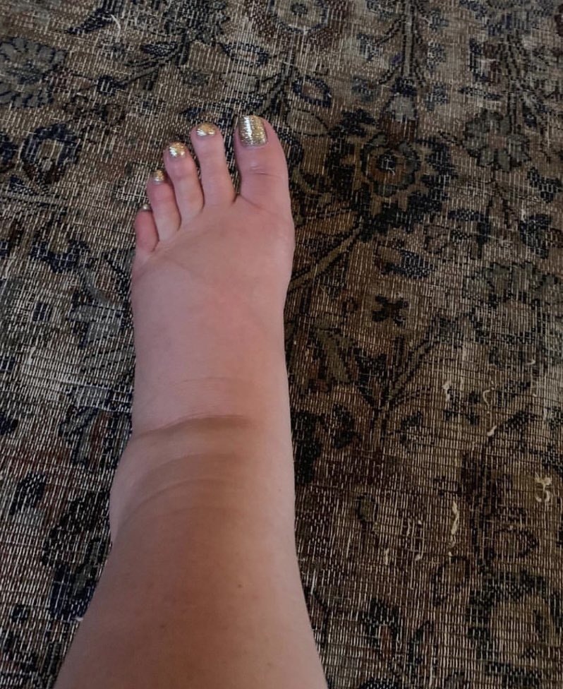 My ankle every time I have a nice event coming up where I have to wear heels: