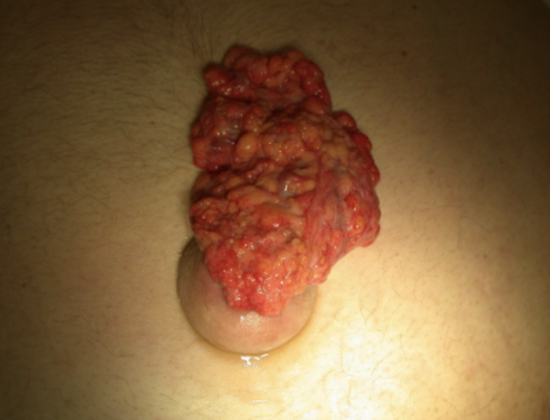 🪴 coffeeandblades 🪴 tweet media