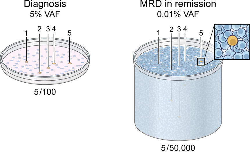 Achieving MRD negativity in #AML: how important is this and how do we get there? ashpublications.org/hematology/art…