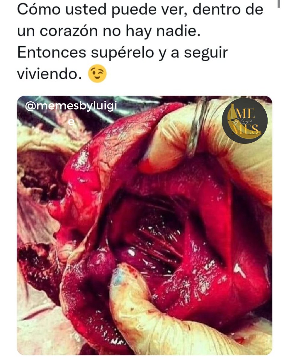 Ahora que sabes la verdad no te hagas la que no entiendes...

 #corazon #corazón #heart #pordentro #inside #nohaynada #memesespañol #memesbyluigie #memeshearts #heartmemes