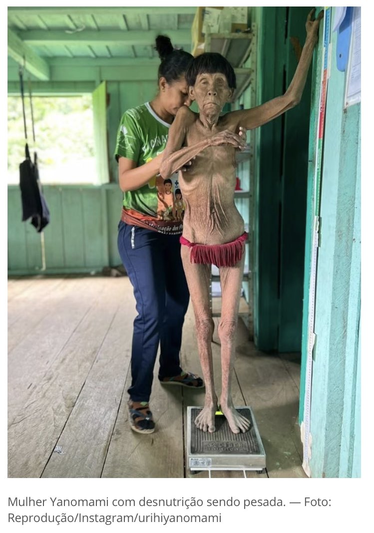 rezittak's tweet photo. @Brunaazevedo22 muuu. 
Mediocridade é o desgoverno deixar o povo chegar a esse ponto. 
Quem não sente, a dor do outro não merece meu respeito. Cretina! https://t.co/4GfQZ5abNK